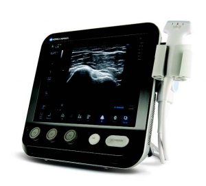 Read more about the article SONIMAGE® MX1 Portable Ultrasound System